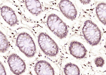 Phospho-CDK1 (Thr161) Rabbit Polyclonal Antibody