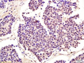 Phospho-CDK1 (Thr161) Rabbit Polyclonal Antibody