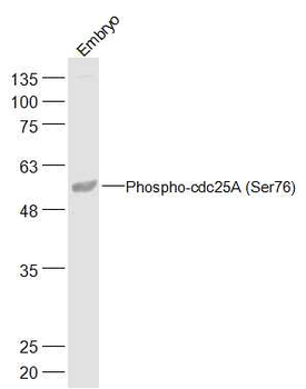 Phospho-cdc25A (Ser76) Rabbit Polyclonal Antibody