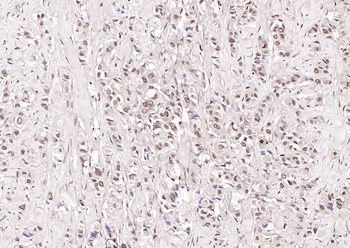 Phospho-cdc25A (Ser178) Rabbit Polyclonal Antibody