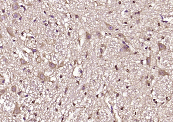 CDC42 Rabbit Polyclonal Antibody