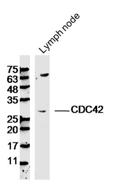 CDC42 Rabbit Polyclonal Antibody