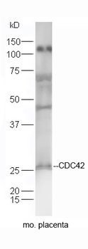 CDC42 Rabbit Polyclonal Antibody