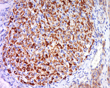 CDC42 Rabbit Polyclonal Antibody