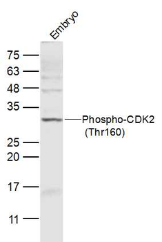 Phospho-CDK2 (Thr160) Rabbit Polyclonal Antibody