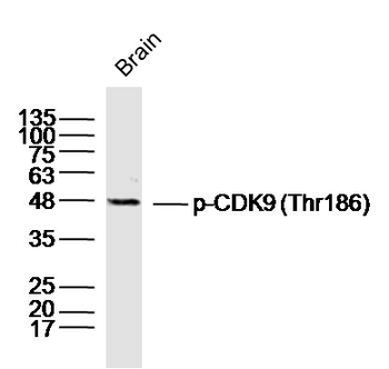 Phospho-CDK9 (Thr186) Rabbit Polyclonal Antibody