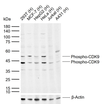 Phospho-CDK9 (Thr186) Rabbit Polyclonal Antibody