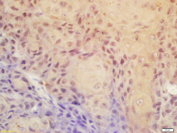 Phospho-CDK9 (Thr186) Rabbit Polyclonal Antibody