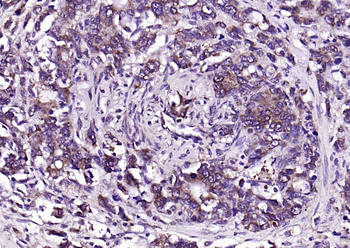 CEA Rabbit Polyclonal Antibody