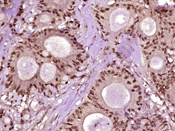 Phospho-CEBP alpha (Thr222 + Thr226) Rabbit Polyclonal Antibody