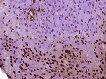 Phospho-CEBP alpha (Thr222 + Thr226) Rabbit Polyclonal Antibody