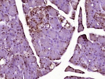 Phospho-CEBP alpha (Thr222 + Thr226) Rabbit Polyclonal Antibody