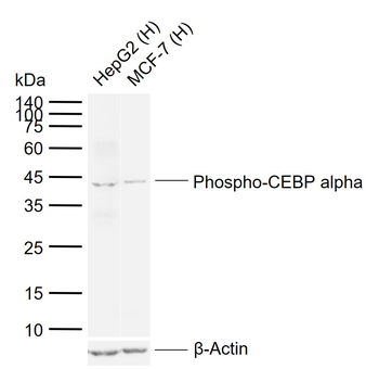 Phospho-CEBP alpha (Thr222 + Thr226) Rabbit Polyclonal Antibody