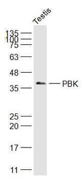PBK Rabbit Polyclonal Antibody