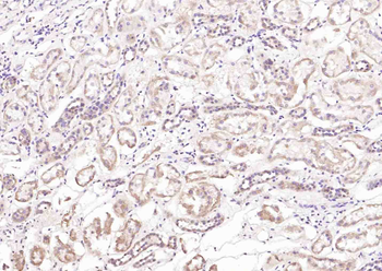 TSPO/PBR Rabbit Polyclonal Antibody