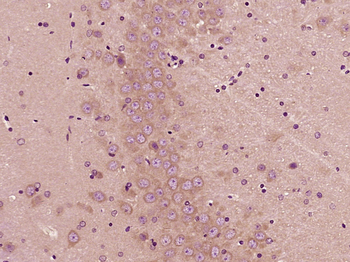 TSPO/PBR Rabbit Polyclonal Antibody