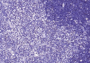 CENPA Rabbit Polyclonal Antibody
