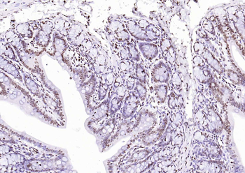 CENPA Rabbit Polyclonal Antibody