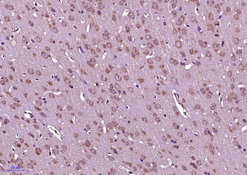 Phospho-ERBB3 (Tyr1197) Rabbit Polyclonal Antibody