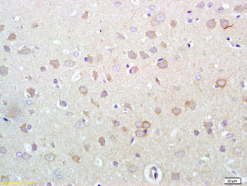 Phospho-ERBB3 (Tyr1289) Rabbit Polyclonal Antibody
