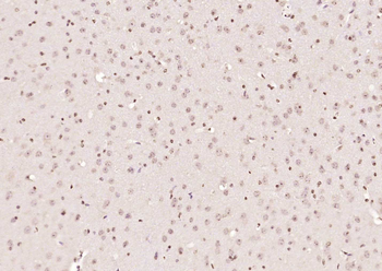 Phospho-HER4 (Tyr1284) Rabbit Polyclonal Antibody