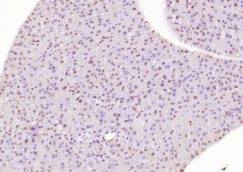 Phospho-HER4 (Tyr1284) Rabbit Polyclonal Antibody