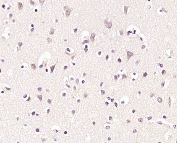 Phospho-HER4 (Tyr984) Rabbit Polyclonal Antibody