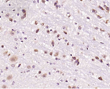 Phospho-HER4 (Tyr984) Rabbit Polyclonal Antibody