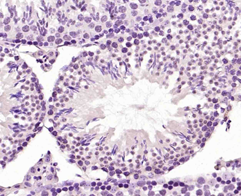 Phospho-HER4 (Tyr984) Rabbit Polyclonal Antibody