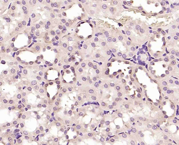 Phospho-HER4 (Tyr984) Rabbit Polyclonal Antibody