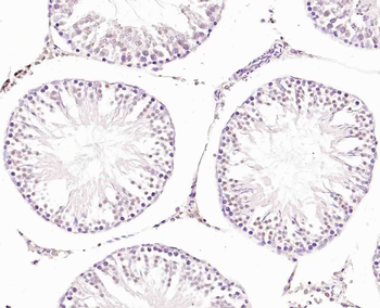 Phospho-HER4 (Tyr984) Rabbit Polyclonal Antibody