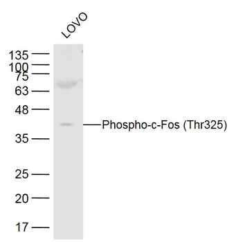 Phospho-c-Fos (Thr325) Rabbit Polyclonal Antibody