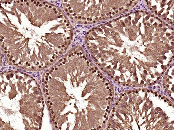 Phospho-CHEK2 (Thr68) Rabbit Polyclonal Antibody