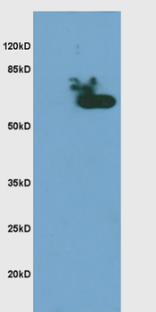 Phospho-CHEK2 (Thr68) Rabbit Polyclonal Antibody
