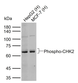 Phospho-CHEK2 (Ser19) Rabbit Polyclonal Antibody