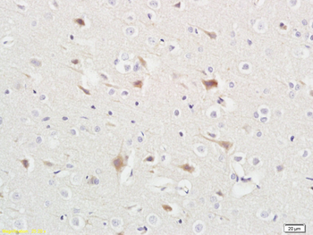 ABHD5 Rabbit Polyclonal Antibody