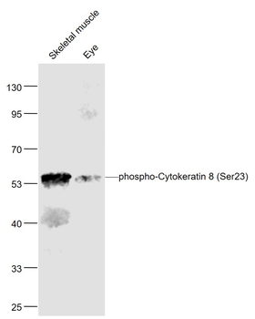 Phospho-Cytokeratin 8 (Ser23) Rabbit Polyclonal Antibody