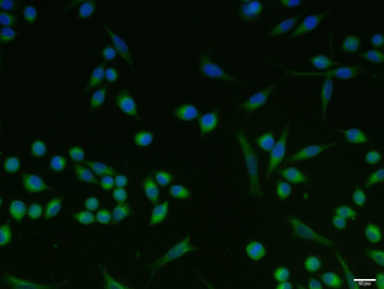 CK10 Rabbit Polyclonal Antibody