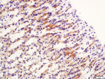 CK10 Rabbit Polyclonal Antibody