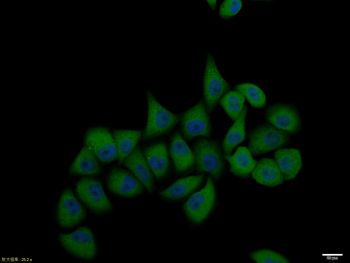 Phospho-Cytokeratin 17 (Ser44) Rabbit Polyclonal Antibody