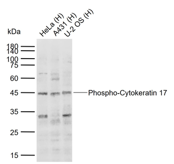 Phospho-Cytokeratin 17 (Ser44) Rabbit Polyclonal Antibody