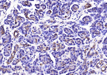 CK18 Rabbit Polyclonal Antibody