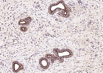 CK18 Rabbit Polyclonal Antibody