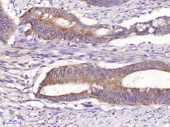 Cytokeratin 19 Rabbit Polyclonal Antibody
