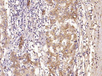 Cytokeratin 19 Rabbit Polyclonal Antibody