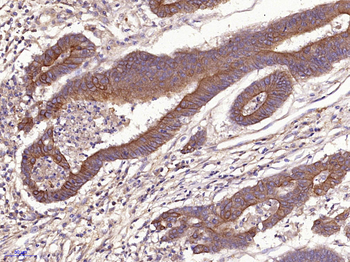 Cytokeratin 19 Rabbit Polyclonal Antibody