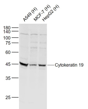 Cytokeratin 19 Rabbit Polyclonal Antibody