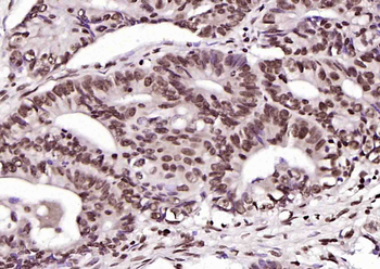 Phospho-Crkl (Tyr251) Rabbit Polyclonal Antibody