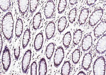 Phospho-Crkl (Tyr251) Rabbit Polyclonal Antibody