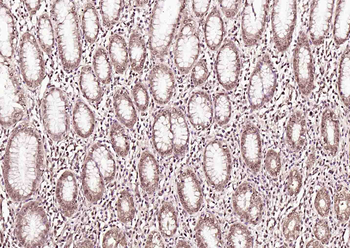 Phospho-Crkl (Tyr251) Rabbit Polyclonal Antibody